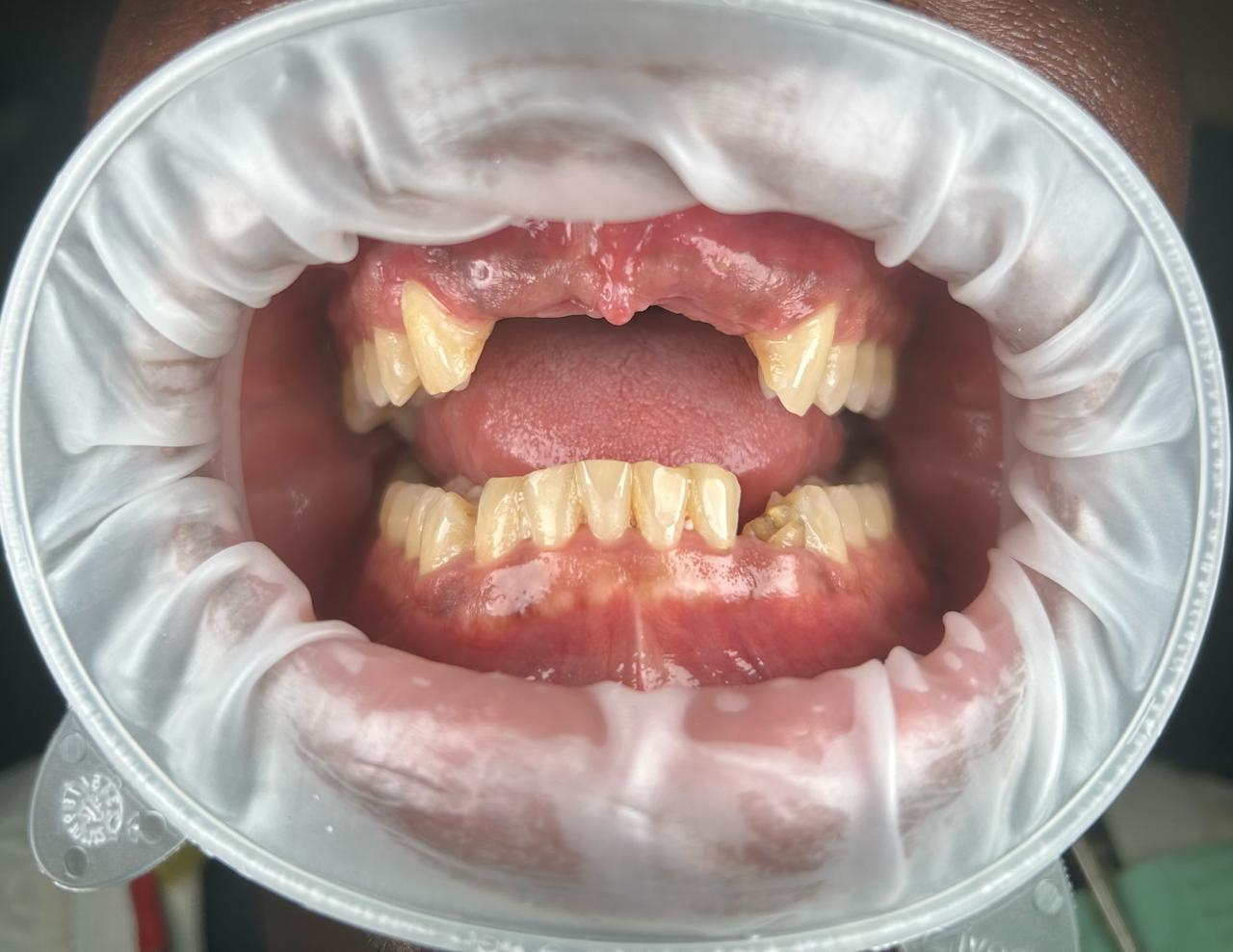 case 1