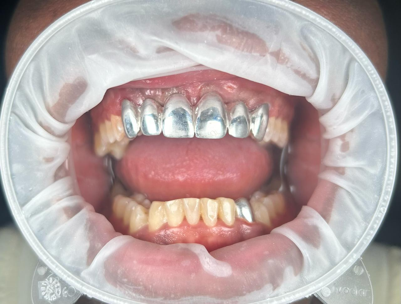 case 2