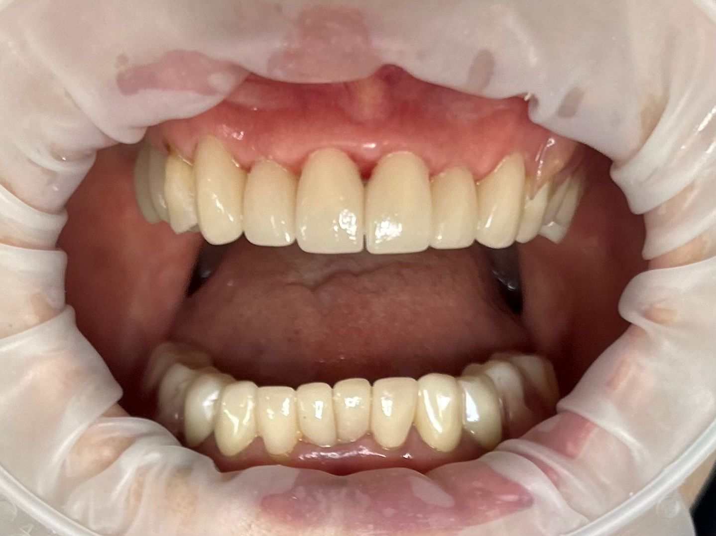 case 4