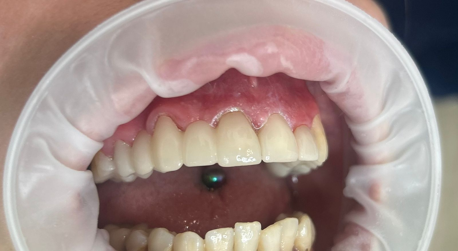 case 5